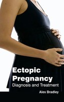 Alex Bradley | Ectopic Pregnancy | Buch | Englisch (2015) | Gebunden