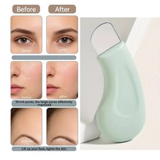2PCS - Facial Blackhead Removal Tool Nose Deep Cleansing Remove Whitehead Acne