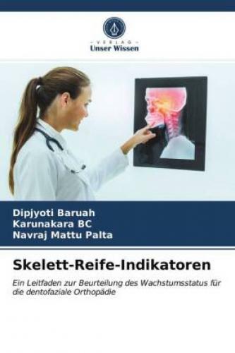 Thumbnail - Skelett-reife-indikatoren Ein Leitfaden Zur Beurteilung Des