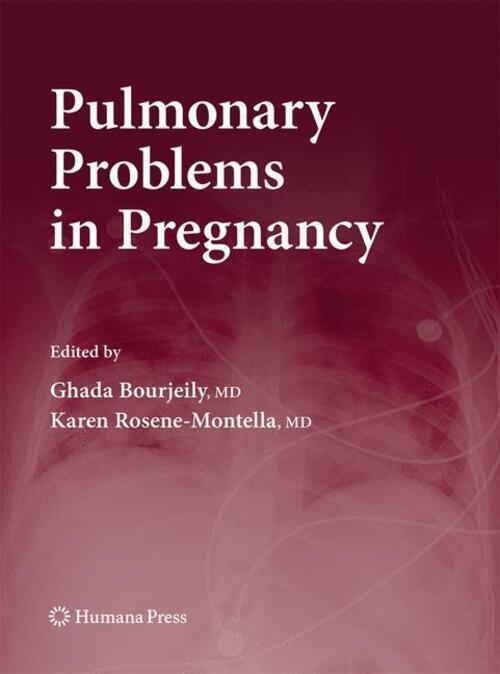 Thumbnail - Karen Rosene-montella (u. A.) | Pulmonary Problems In Pregnancy |