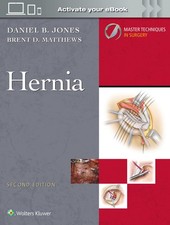 Master Techniques in Surgery Hernia Print + e...