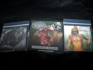 3 CDr LOT - NEW! MARCH 2026 *HYDROENCEPHALOCYSTOCELE +HEMORRHAGIC NECROTIZING X2