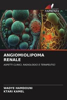 Wadye Hamdouni (U. A.) | Angiomiolipoma Renale | Taschenbuch | Italienisch
