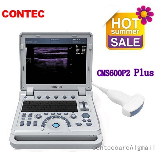 convex lcd display brands