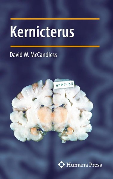 David W. Mccandless | Kernicterus | Taschenbuch | Englisch (2014) | Xiv | Humana-image