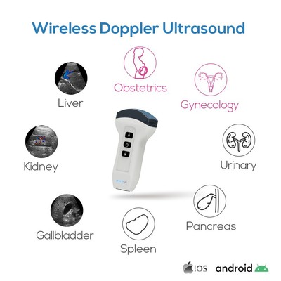 Color Doppler Handheld Wireless Ultrasound Abdominal Scanner Human Convex Probe