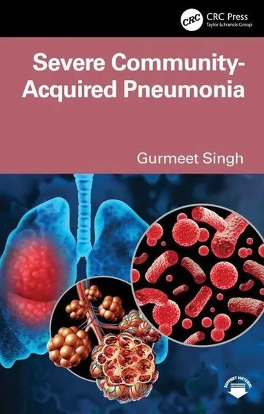 Severe Community-Acquired Pneumonia | Gurmeet Singh | Taschenbuch | Englisch-image