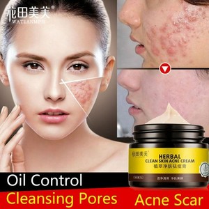 pimple herbal cream