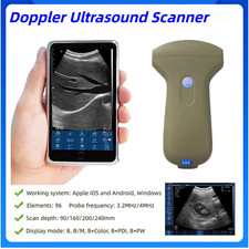 Portable WiFi Handheld Ultrasound Machine Convex Probe 96 Elements Color Doppler