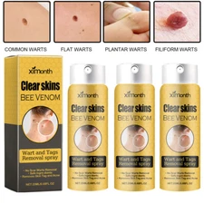 Tag Recede Bee Venom Treatment Spray Tag Recede Bee Venom Spray for All Skin Hot