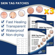 720PCS Skin Tag Remover Patches Quick Effective Mole Wart Removal Pad Sticker