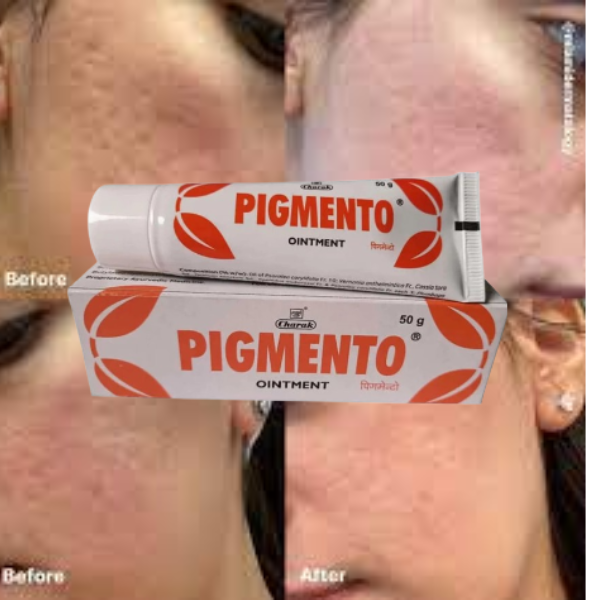 100% Herbal Pigmento Ointment (50gm) for Ayurvedic Skin Wellness