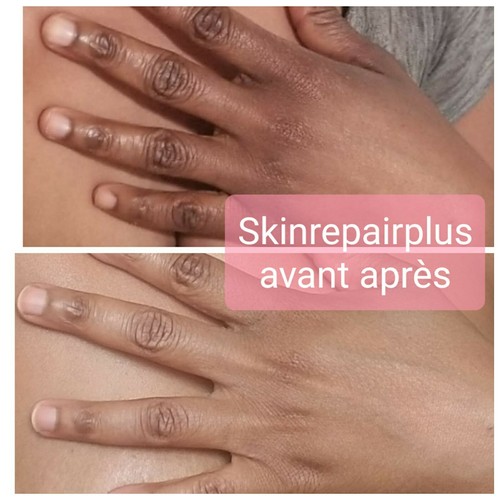 Crème SOIN Effaceur d'hyperpigmentation pour phalanges, pieds - Zdjęcie 15 z 17