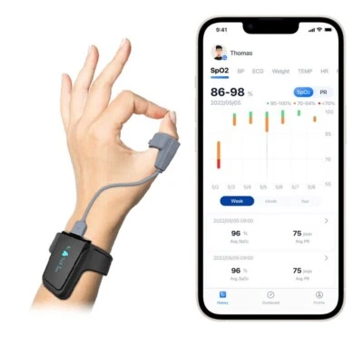 Trendmedic Viatom Checkme O2 - Handgelenk Pulsoximeter mit Vibrations-Sensor