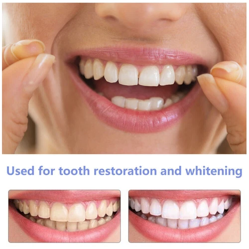 Set superiore e inferiore a scatto denti finti faccette dentali protesi copertura denti US - Foto 11 di 12
