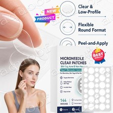 2026 NEW Curalona Microneedle Patches 144pcs, Skin Tag Wart Acne Remover Patches