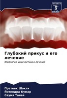 Glubokij Prikus I Ego Lechenie Jetiologiq, Diagnostika I Lechenie Shakti (U. A.)