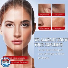 Kojic Acid Cream, Face and Body Gel, Dark Spots, Melasma, Natural Ingredients...