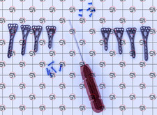 2.7mm Distal Radius Volar Variable Angle Locking Plates  Screw 79 Pcs Set :
