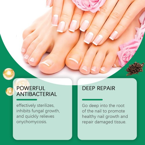 1-10PCS Nailshield Anti Fungal Stick, Natural Solution for Foot Toe Healthy 10ml - Picture 11 of 19