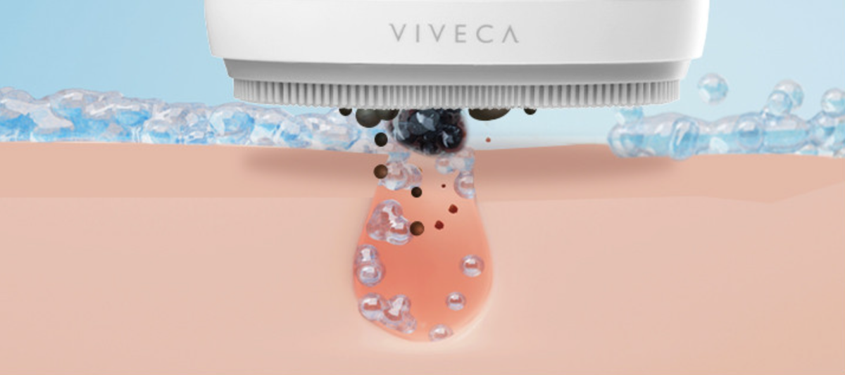Viveca Ultrasonic Vibrating Cleanser /. | eBay