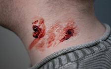 Vampire Bites -Encapsulated Silicone Prosthetic SFX Makeup Appliance, Halloween