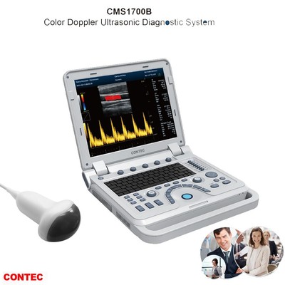 CONTEC Tragbares Farbdoppler-Ultraschallscannergerät+4D-Volumensonde CMS1700B,CE