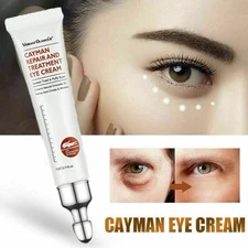 Eye Cream Instant Remove Eye Bags Dark Circles Anti Wrinkle Depuffing Firming