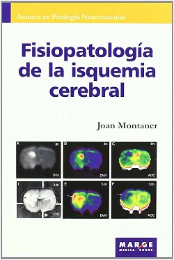 Fisiopatología de la isquemia cerebral. NUEVO. Envío URGENTE (IMOSVER) - Imagen 1 de 1