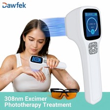 308nm UVB Phototherapy Lamp Device Home Use Portable Targeted Skin Treatment