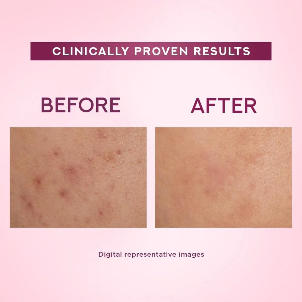 Crema ligera Pond's Bright Beauty 50 g con filtro UV niasorcinol desvanece manchas oscuras Foto 4 de 4