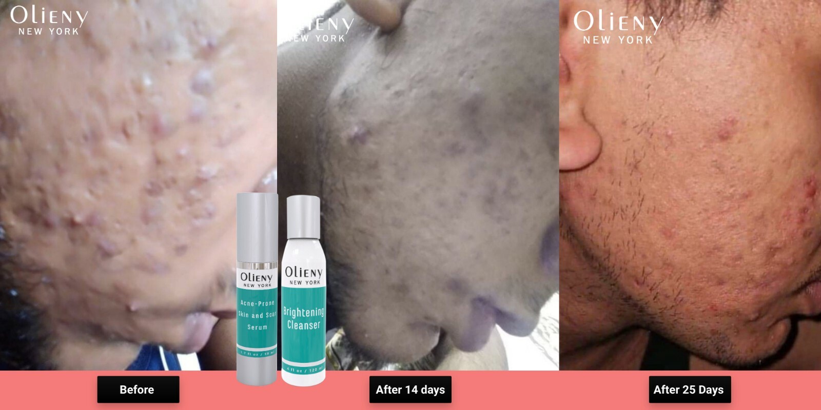 Olieny CREMA LIMPIADORA 100% ORIGINAL ELIMINA ACNÉ, MANCHAS, PAÑO! Amida de niacina