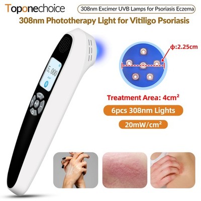 308nm UVB Home Therapy Device Eczema Skin Care Ultraviolet Light 0-5J/cm2
