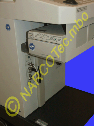 SIEMENS Sonoline SI 250 - Bild 4 von 12