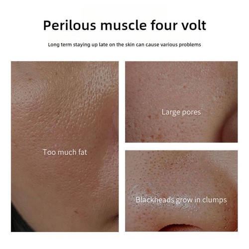 Herbal Spots Peel-Off Facial Mask, Facial Mask,Peel Mask ml Off 100 X0S4 - Picture 10 of 15