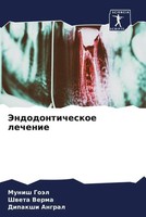 Munish GoäL (U. A.) | Jendodonticheskoe Lechenie | Taschenbuch | Russisch (2023)