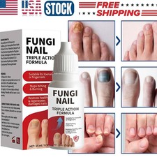 Fungi-Nail Anti-Fungal Liquid Solution Kills Fungus That Can Lead To Nail