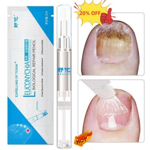 3ML Pilz Nagel Behandlung Liquid Pen Nagel Finger Zehe Repair Remover 2025HOT - Picture 2 of 14
