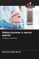 Shivpriya Aher Borse | Malocclusione A Morso Aperto | Taschenbuch | Italienisch