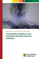 Tomografia Multislice Com Protocolo De Baixa Dose De RadiaçãO Kaline Antunes