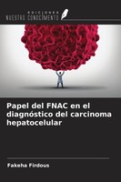 Papel Del Fnac En El DiagnóStico Del Carcinoma Hepatocelular Fakeha Firdous