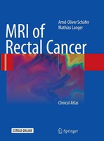 Arnd-Oliver SchäFer (U. A.) | MRI Of Rectal Cancer | Taschenbuch | Englisch