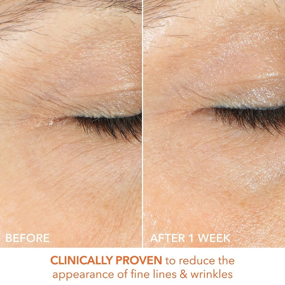 Новый Dr. Dennis Gross витамин C молочный твердый и яркий глаз лечение новый подлинный - Изображение 4 из 4