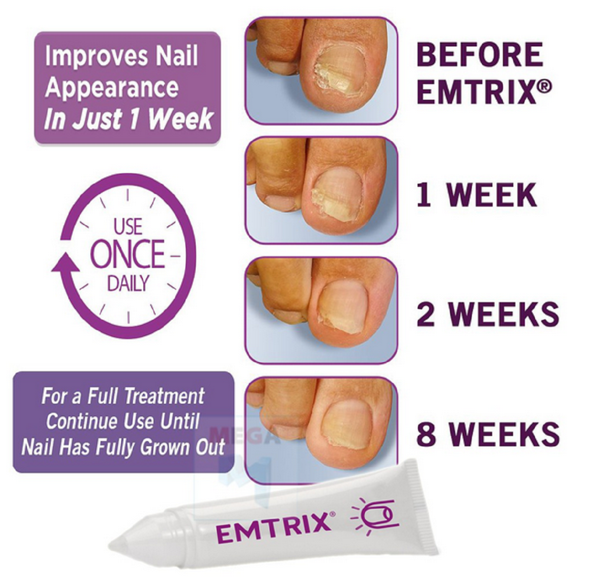 EMTRIX Fungal Discolored Brittle Crack Nail Revive Cream 2Week