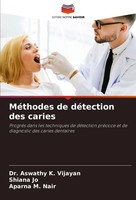 Aswathy K. Vijayan (U. A.) | MéThodes De DéTection Des Caries | Taschenbuch