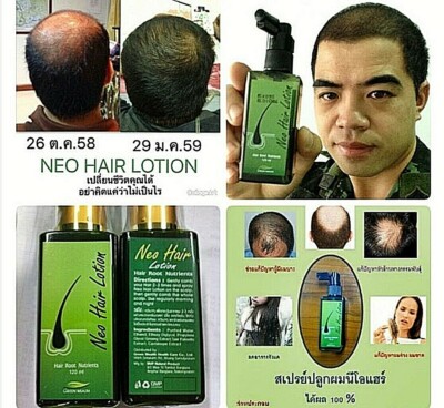 120x1Neo Hair Lotion Nutrients Root HAIR BEARD SIDEBURNS LONGER Original Herbs