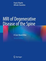 MRI Of Degenerative Disease Of The Spine Paola D'aprile