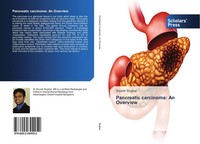 Soumil Singhal | Pancreatic Carcinoma: An Overview | Taschenbuch | Englisch