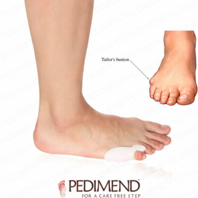 Pedimend  Silikongel Pinky Zehentrenner und Schneiderballenkorrektor (1 PAAR)