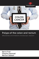 Dorra Trad (U. A.) | Polyps Of The Colon And Rectum | Taschenbuch | Englisch